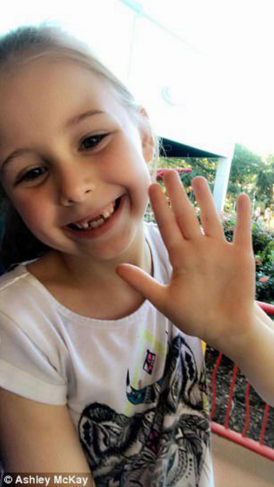 Αυστραλία: Κοριτσάκι με αυτισμό κάλεσε 15 φίλους και πήγαν μόνο δύο, αλλά εμφανίστηκαν στο πάρτι της 150 άγνωστοι