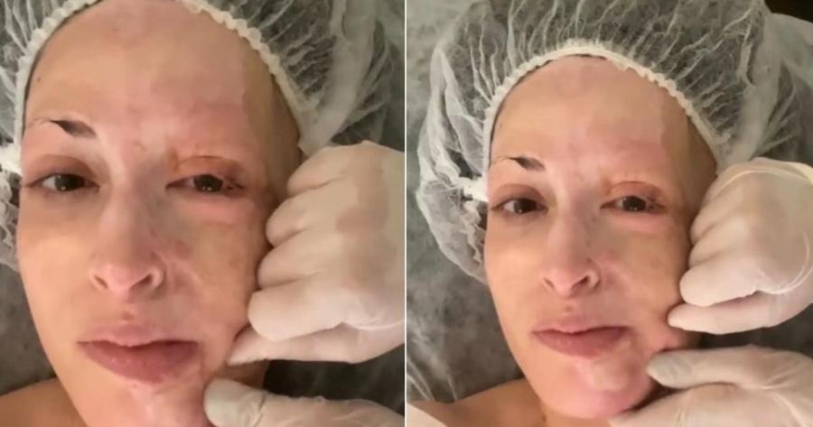 Ιωάννα Παλιοσπύρου: Χωρίς μακιγιάζ και με δύναμη ψυχής μας δείχνει το μασάζ που κάνει στο πρόσωπο μετά τις επεμβάσεις