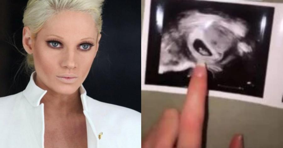 “Η εγκυμοσύνη δεν αντέχεται”: Η Τζούλια Αλεξανδράτου ποζάρει με μαγιό μετά την ανακοίνωση για την εγκυμοσύνη