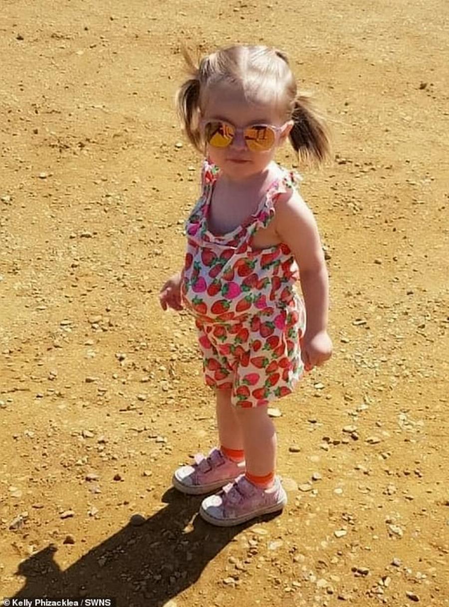 Δίχρονο κοριτσάκι ζει με το στομάχι έξω από το σώμα του, εξαιτίας μιας σπάνιας πάθησης