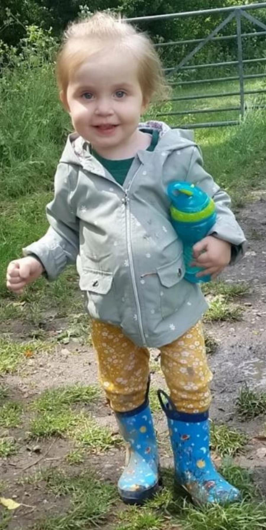 Δίχρονο κοριτσάκι ζει με το στομάχι έξω από το σώμα του, εξαιτίας μιας σπάνιας πάθησης