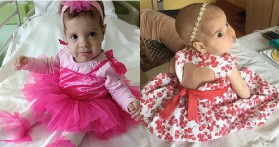 H ιστορία της μικρής Άννας – Αποστολίας: Ύστερα από 18 μήνες στο νοσοκομείο μπορεί και πάλι να χαμογελά