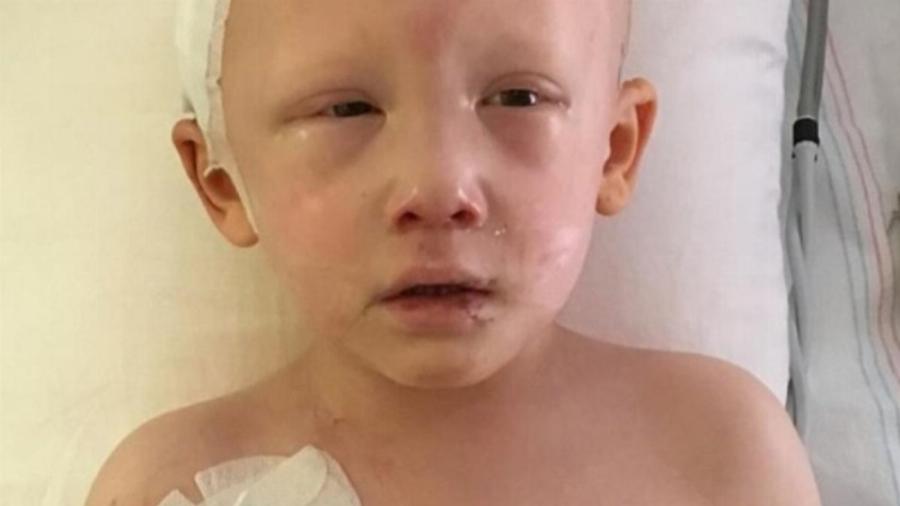 Ψιθύρισε 3 λέξεις και τους “πάγωσε” όλους: 3χρονο αγοράκι με καρκίνο ανοίγει τα μάτια του για τελευταία φορά