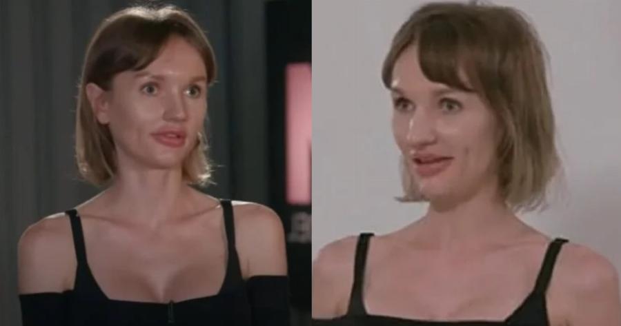 Συνέχισε τις πλαστικές και μοιάζει με κοριτσάκι: Αγνώριστη η υποψήφια του GNTM