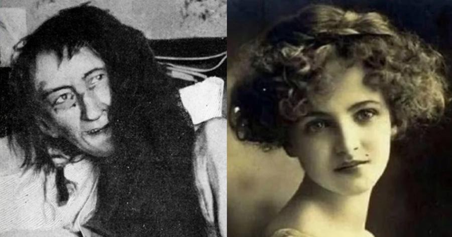 Την κλείδωσαν για 25 χρόνια στη σοφίτα: Η απάνθρωπη τιμωρία μιας μητέρας στην κόρη της, γιατί αγάπησε τον λάθος άντρα