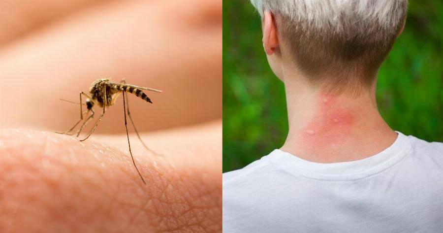 Βάλε τέλος στα κουνούπια: 4 πράγματα που τα απωθούν από το να σου ρουφήξουν το αίμα