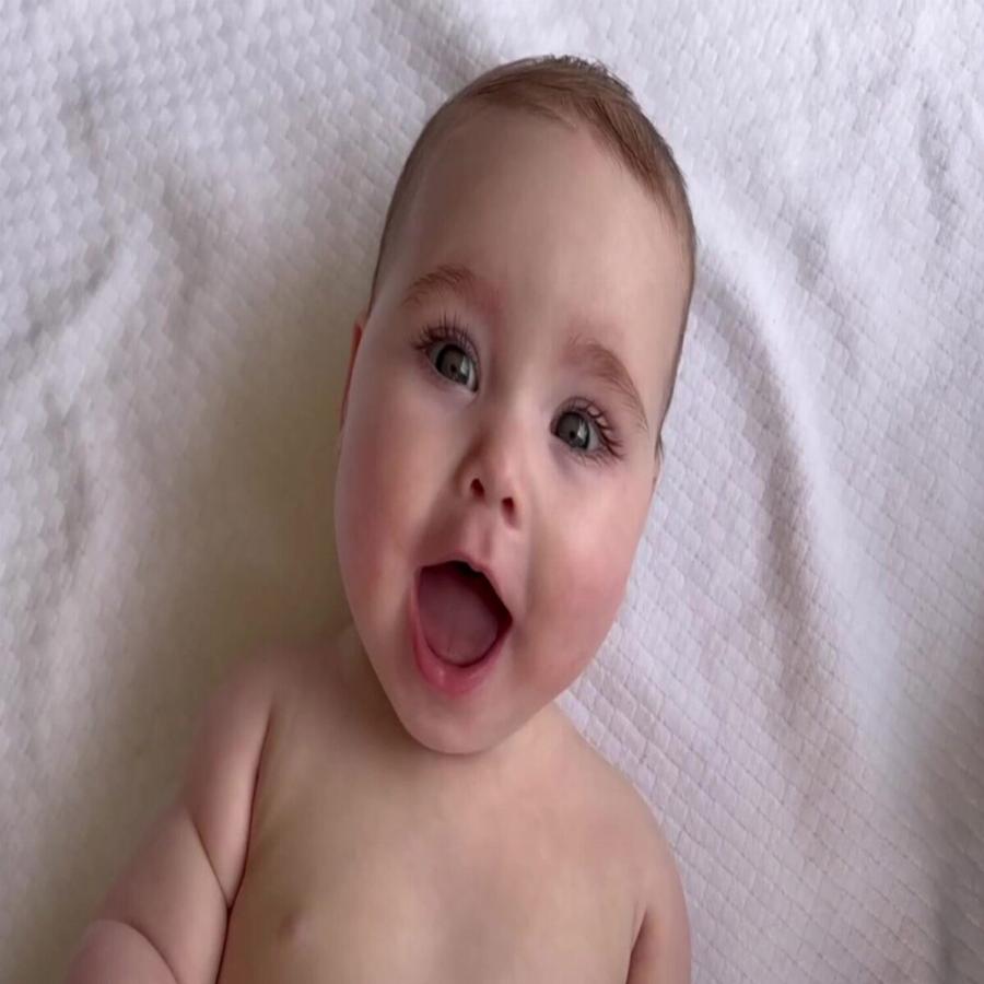 Η ξεχωριστή μικρή Isa: Γεννήθηκε με ανισοσκελία και είναι το μωρό της Gerber για το 2022