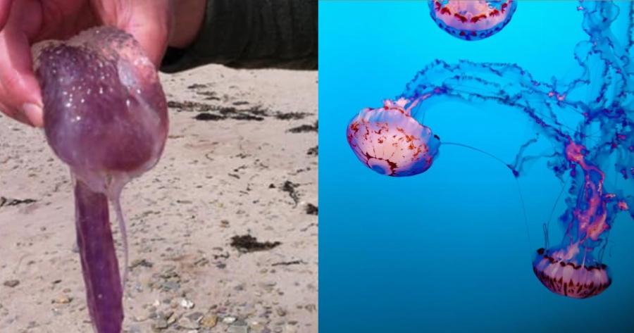 Χανιά: Διπλό τσίμπημα από μωβ μέδουσες σε τουρίστρια – Εμφάνισε πόνο, ζαλάδα και ταχυπαλμία