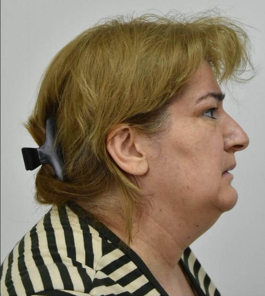 Νέα Ερυθραία: Αυτή είναι η οικιακή βοηθός που νάρκωνε ηλικιωμένους για να τους κλέψει