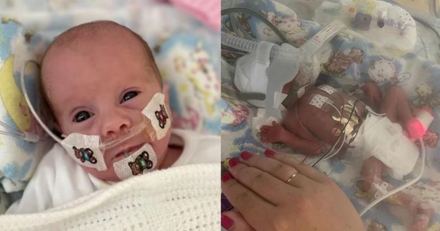 Αληθινή ιστορία: Προωράκι καταδικασμένο να μην ζήσει ούτε ένα λεπτό, γίνεται 1 έτους!