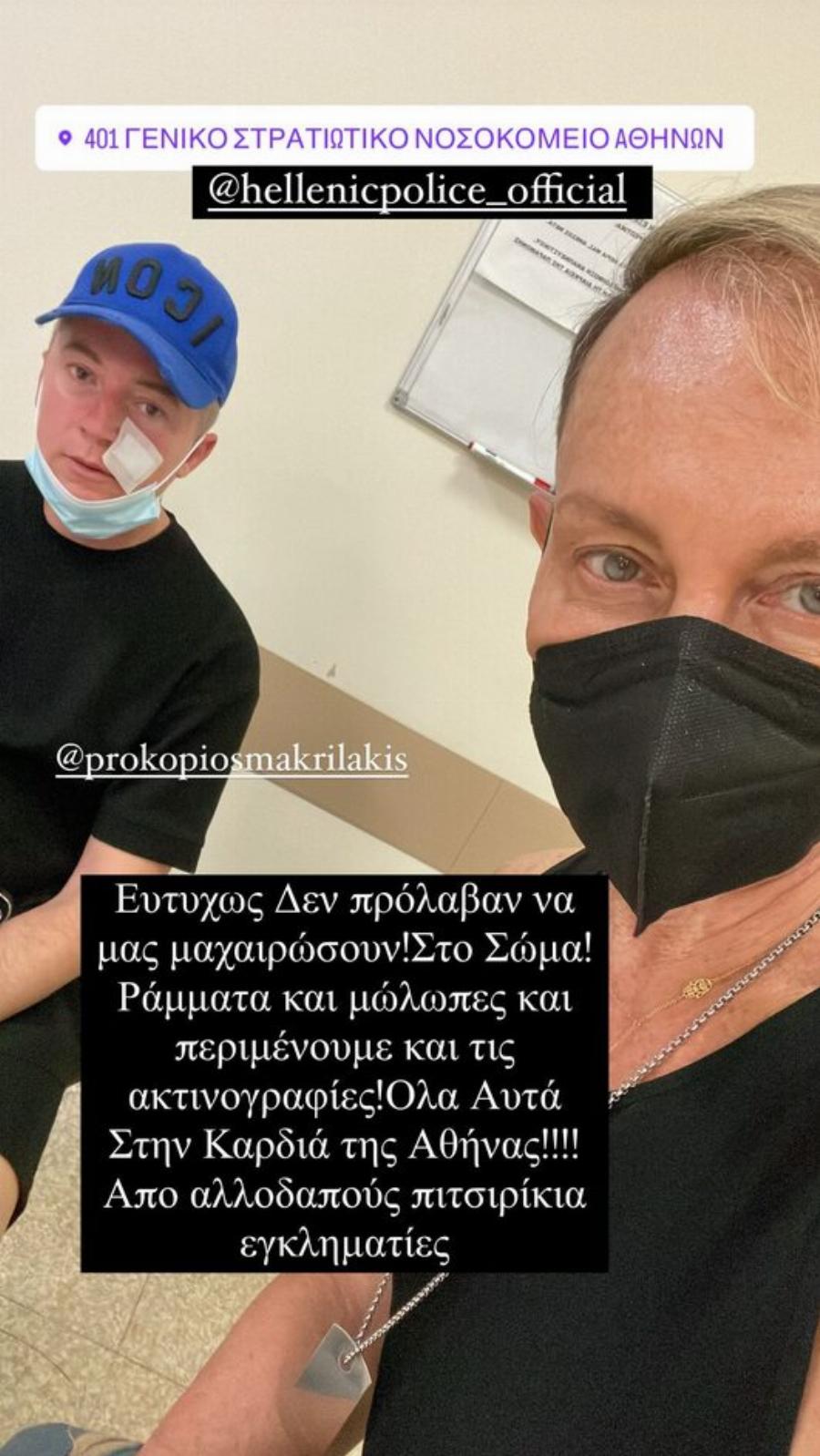 Του επιτέθηκαν στη πλατεία Συντάγματος: Ο Βασίλειος Κωστέτσος θύμα άγριας επίθεσης από αλλοδαπούς στην Αθήνα