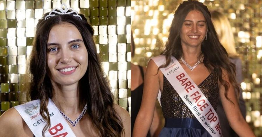 Χωρίς ίχνος μακιγιάζ στα καλλιστεία: Η Μις Αγγλία γίνεται η πρώτη στην ιστορία των καλλιστείων που διαγωνίζεται αμακιγιάριστη