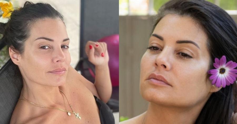 Βάζει κάτω όλες τις ινφλουένσερς: Η Μαρία Κορινθίου δείχνει τις ραγάδες στο στήθος της και στέλνει το δικό της μήνυμα