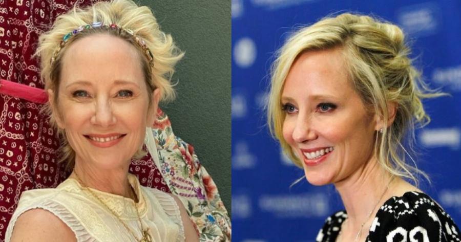 Εγκεφαλικά νεκρή ύστερα από σοβαρό τροχαίο διάσημη ηθοποιός: Θα την αποσυνδέσουν από τη μηχανική υποστήριξη