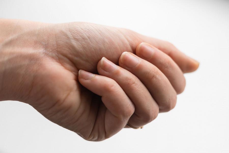 Προσοχή: Τα συμπτώματα σε δάχτυλα, πρόσωπο, λαιμό και ώμους που μαρτυρούν καρκίνο στα πνευμόνια