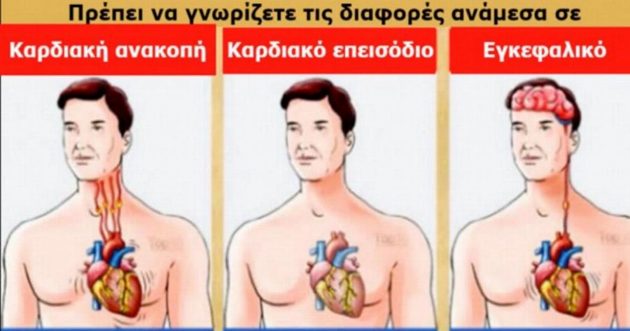Πώς θα καταλάβετε αν παθαίνετε εγκεφαλικό, καρδιακή προσβολή ή ανακοπή;