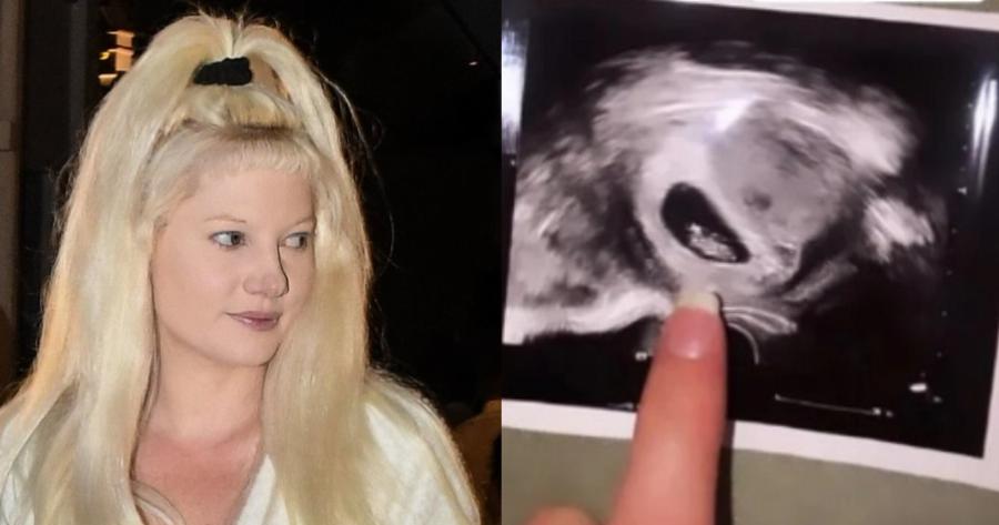 «Βασανιστήριο καθημερινά»: Η Τζούλια Αλεξανδράτου πόζαρε για πρώτη φορά και έδειξε την φουσκωμένη κοιλιά της