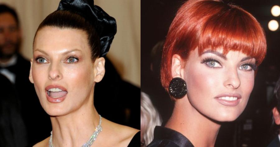 «Δεν κοιτάζομαι στον καθρέπτη»: Αγνώριστη η Λίντα Εβαντζέλιστα – Παραμορφώθηκε μετά από αισθητική επέμβαση