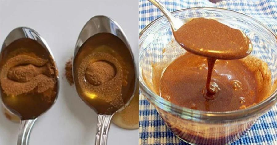 Μέλι και κανέλα: Προλαμβάνει τη γήρανση, βελτιώνει τη λειτουργία της καρδιάς, βοηθάει στην απώλεια βάρους και μειώνει το σάκχαρο του αίματος