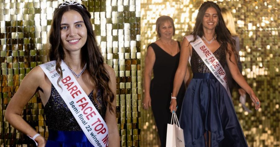 Απίστευτο κιόμως αληθινό: Η Μις Αγγλία έγινε η πρώτη γυναία στην ιστορία των καλλιστείων που διαγωνίζεται χωρίς μακιγιάζ