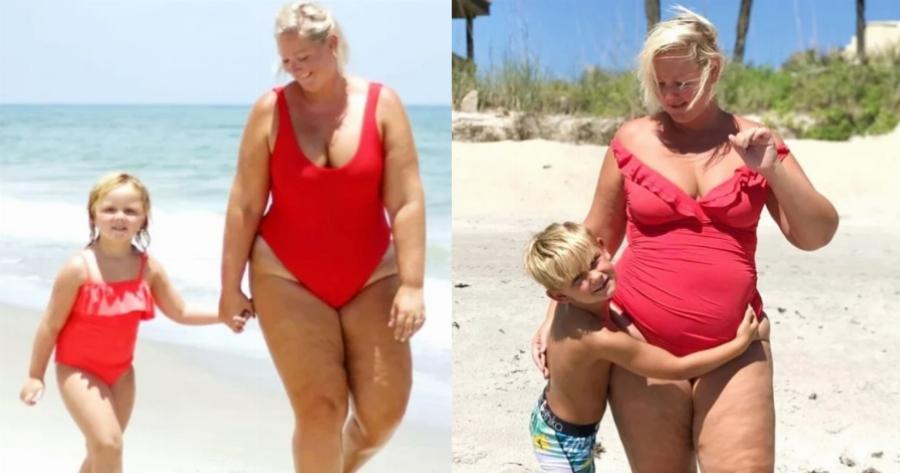 “Είμαι περήφανη για το σώμα μου”: Πηγαίνω παραλία και δεν ντρέπομαι για τα κιλά μου, τις ραγάδες, τη κuτταρiτιδα