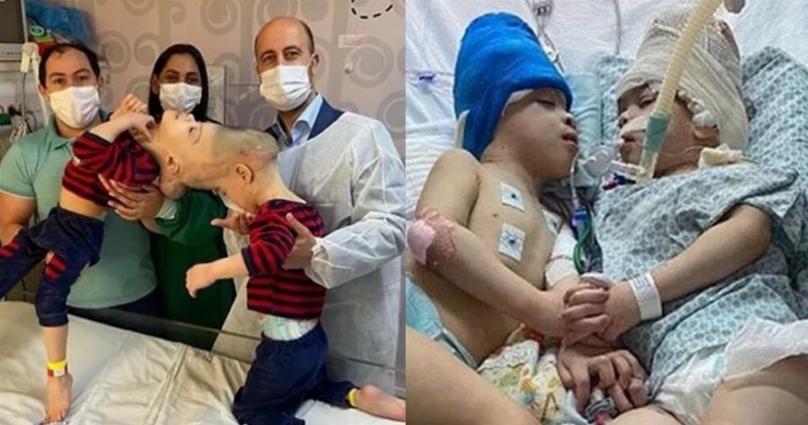 Επιστημονικό θαύμα: Χρειάστηκαν 100 γιατροί και 7 εγχειρήσεις για να χωρίσουν τα σιαμαία αγόρια που είχαν ενωμένο εγκέφαλο