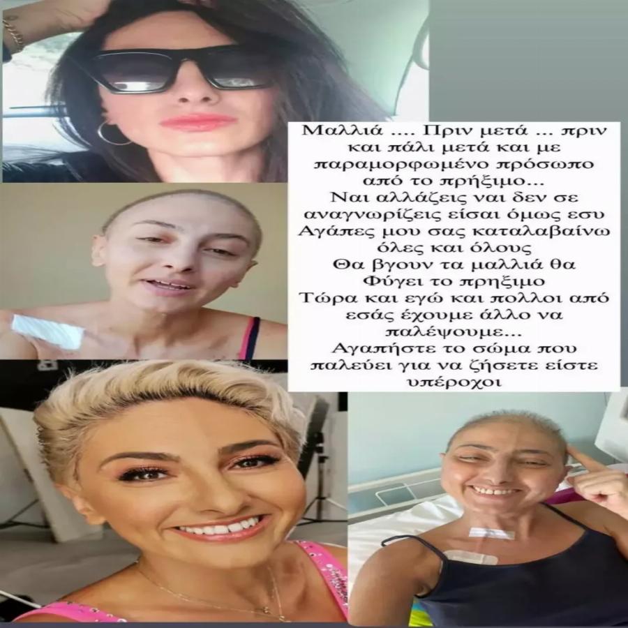 Μια ηρωίδα της ζωής: Η Ρεγγίνα Μακέδου μας δείχνει τις αλλαγές που έχει υποστεί η εμφάνισή της αφότου μετά την περιπέτεια της υγείας της