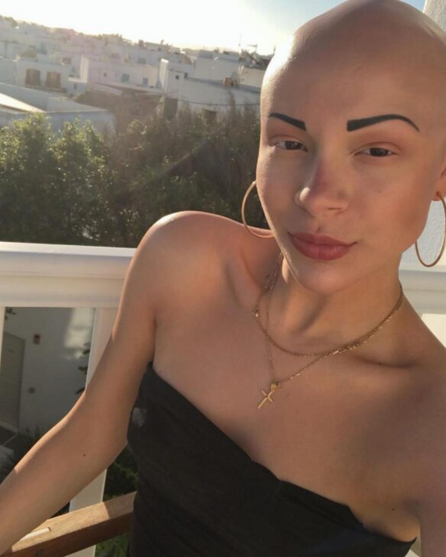 Σήμερα θα κέρδιζε άνετα το GNTM: Η Λυδία Κατσανικάκη είναι το απόλυτο μοντέλο 4 χρόνια μετά την αποχώρηση της από το ριάλιτι