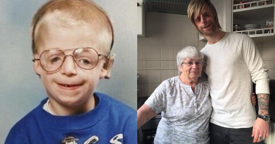 Συγκινεί το αγόρι με σύνδρομο TCS: Τον εγκατέλειψαν οι γονείς του, αλλά τον διάλεξε η θετή μαμά του