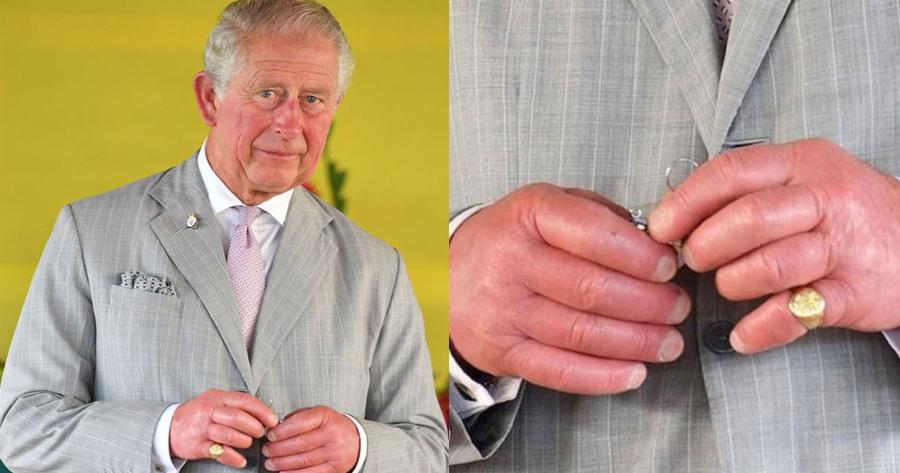 Γιατί τα δάχτυλα του Βασιλιά Καρόλου είναι πρησμένα;