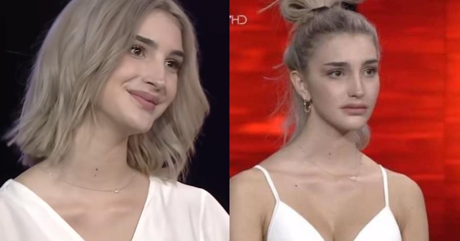 Την είχαν κόψει γιατί είχε φουσκώσει τα χείλη: Φέτος έτσι όπως είναι θα κέρδιζε σίγουρα το GNTM