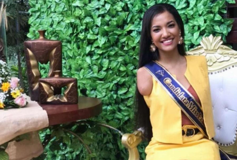 Η ινφλουένσερ που θέλουμε: Η ιστορία της ακρωτηριασμένης Βικτόριας που συγκινεί με την δύναμη της θέλησης της