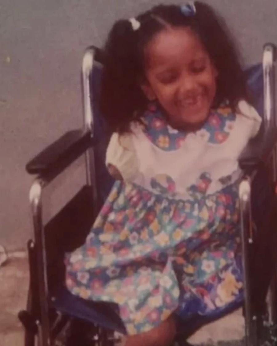 Η ινφλουένσερ που θέλουμε: Η ιστορία της ακρωτηριασμένης Βικτόριας που συγκινεί με την δύναμη της θέλησης της