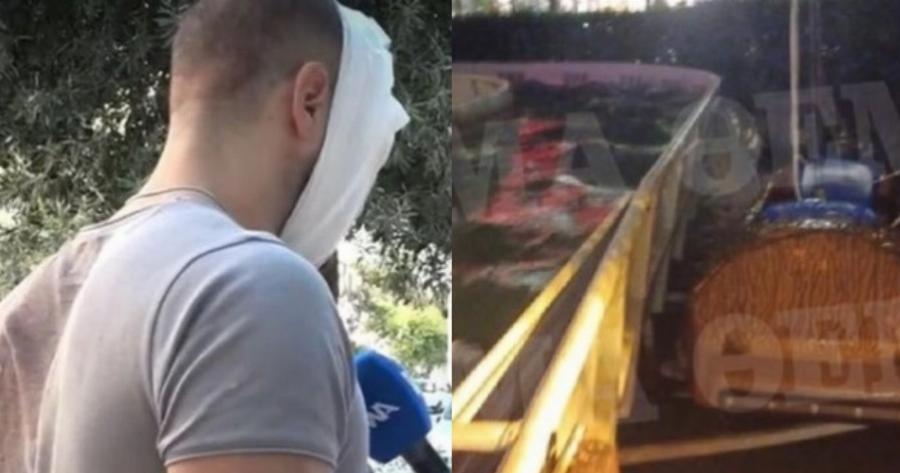 «Με ξύπνησαν λιπόθυμο μέσα στο νερό»: Η ανατριχιαστική περιγραφή ενός από τους 4 τραυματίες του Allou Fun Park