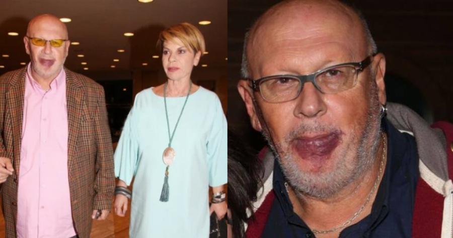 Λάκης Παπαδόπουλος: Ο γάμος, η γέννηση του γιου του, το σημάδι στα χείλη, το bullying και η απώλεια της ακοής στον στρατό