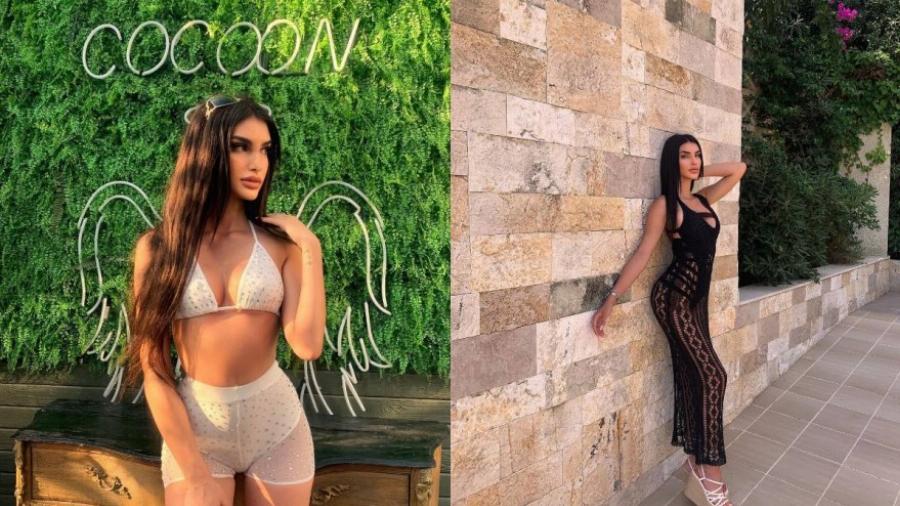 Την είχαν κόψει γιατί είχε φουσκώσει τα χείλη: Φέτος έτσι όπως είναι θα κέρδιζε σίγουρα το GNTM