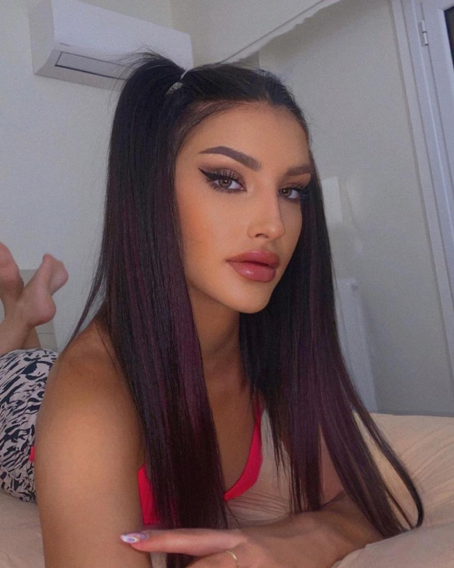 Την είχαν κόψει γιατί είχε φουσκώσει τα χείλη: Φέτος έτσι όπως είναι θα κέρδιζε σίγουρα το GNTM