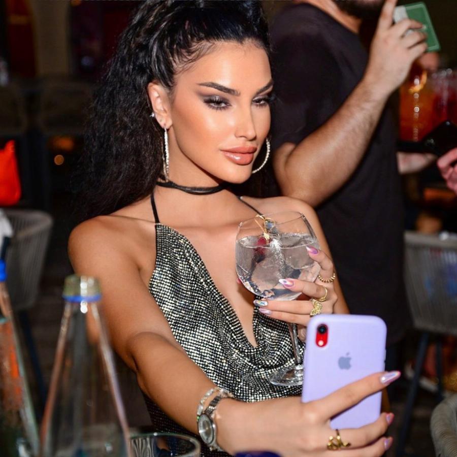 Την είχαν κόψει γιατί είχε φουσκώσει τα χείλη: Φέτος έτσι όπως είναι θα κέρδιζε σίγουρα το GNTM