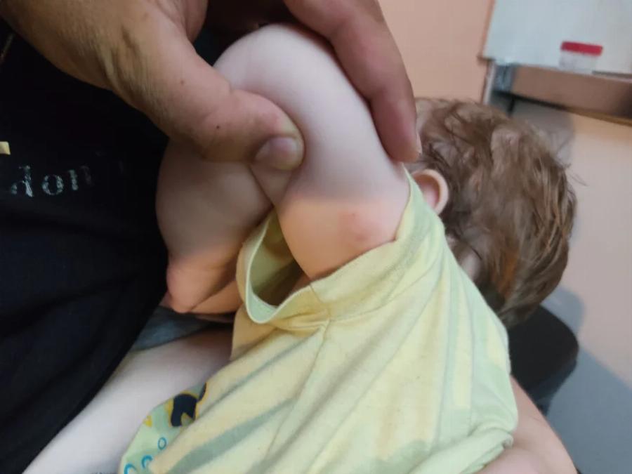 Σοκαριστική επίθεση από σκύλο σε παιδί στην Κρήτη: «Δάγκωνε με μανία το παιδί μου» – Το βρέφος έχει σκίσιμο τριών εκατοστών στο μάτι