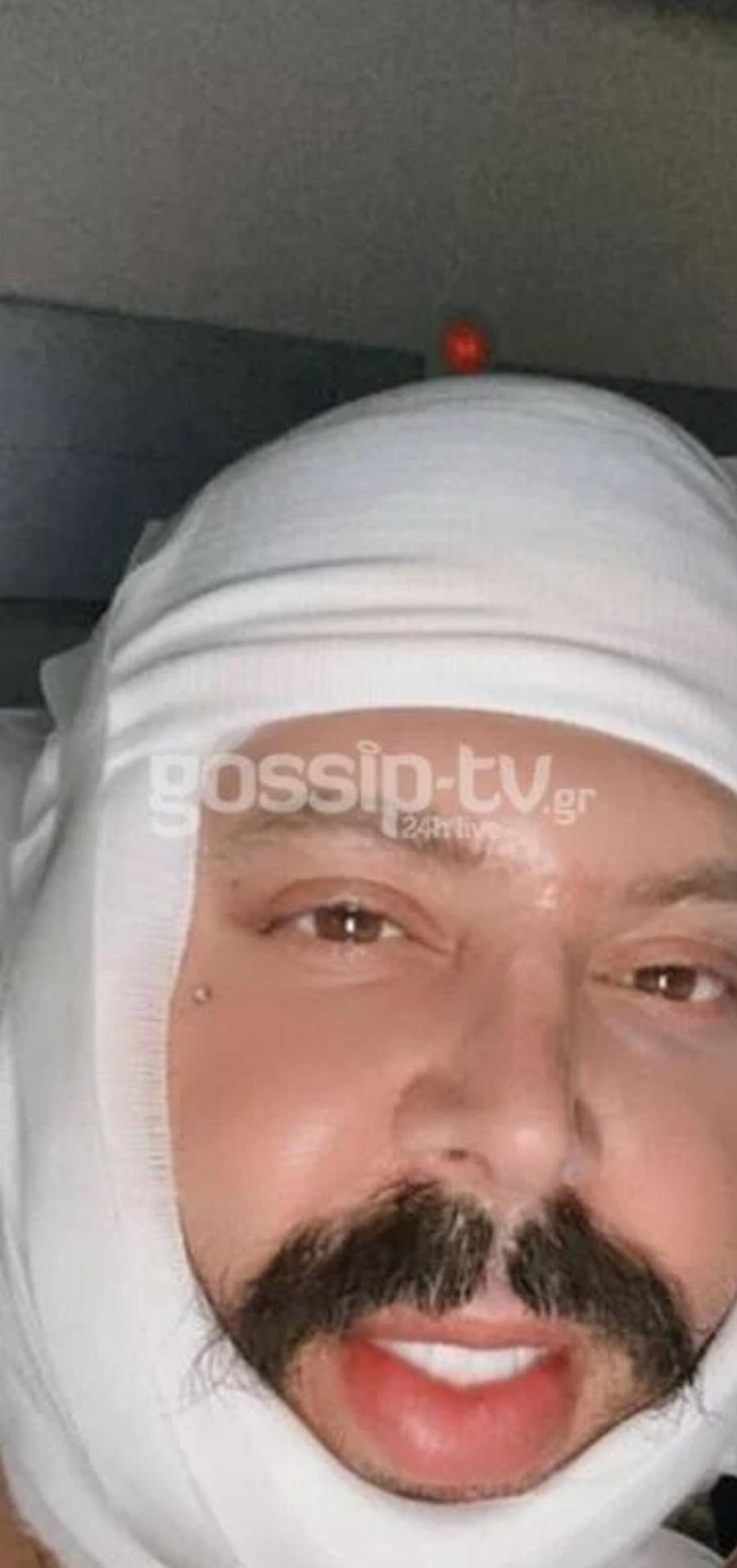 Έβαλε χείλια, δόντια και άλλαξε παντελώς: Αγνώριστος ο Νικόλας του Big Brother 2 χρόνια μετά το τέλος του παιχνιδιού