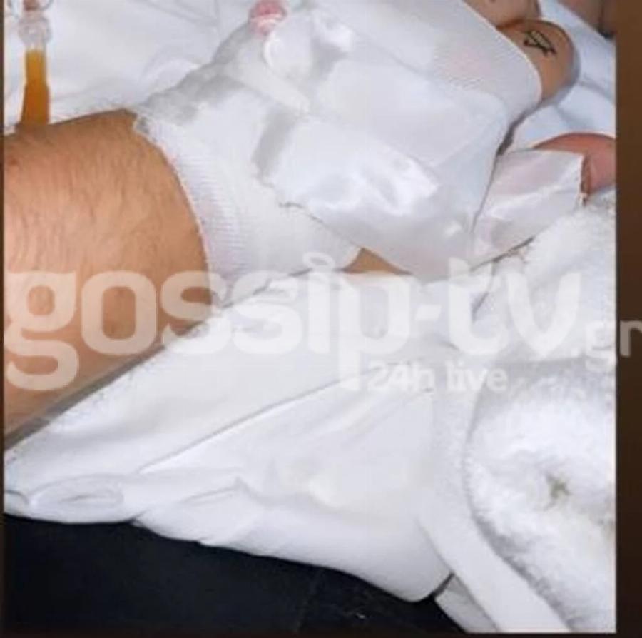 Έβαλε χείλια, δόντια και άλλαξε παντελώς: Αγνώριστος ο Νικόλας του Big Brother 2 χρόνια μετά το τέλος του παιχνιδιού