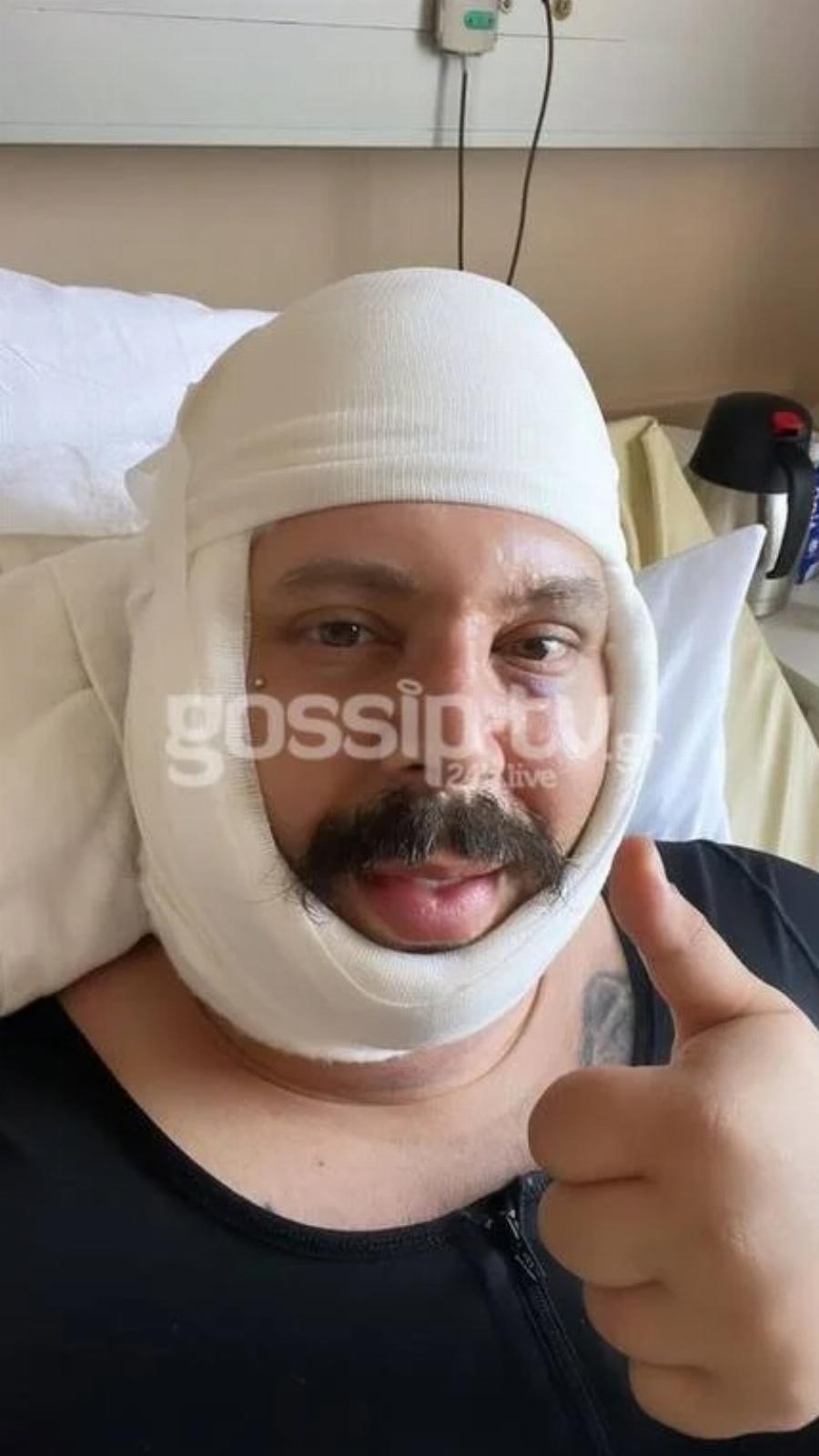 Έβαλε χείλια, δόντια και άλλαξε παντελώς: Αγνώριστος ο Νικόλας του Big Brother 2 χρόνια μετά το τέλος του παιχνιδιού