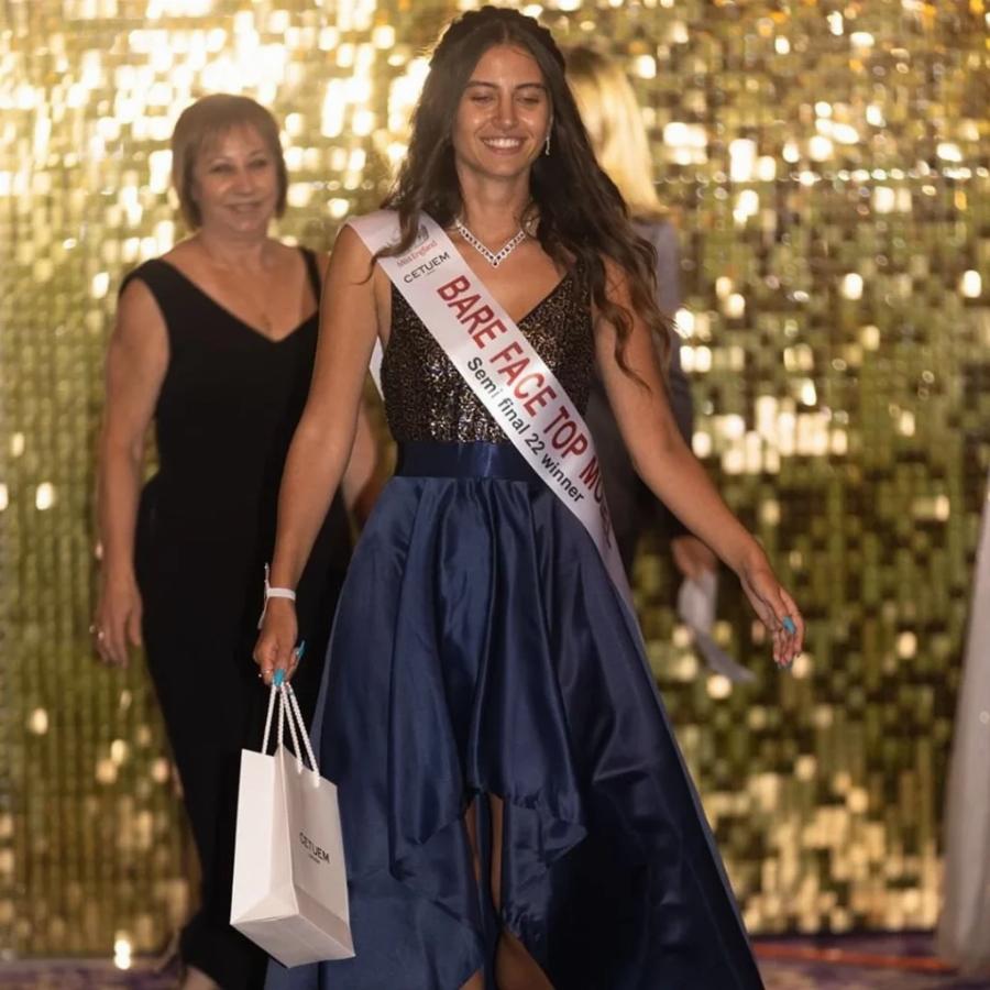 Δεν έχει ξαναγίνει στα 94 χρόνια ιστορίας: Η Μις Αγγλία γίνεται η πρώτη στα καλλιστεία που διαγωνίζεται χωρίς μακιγιάζ