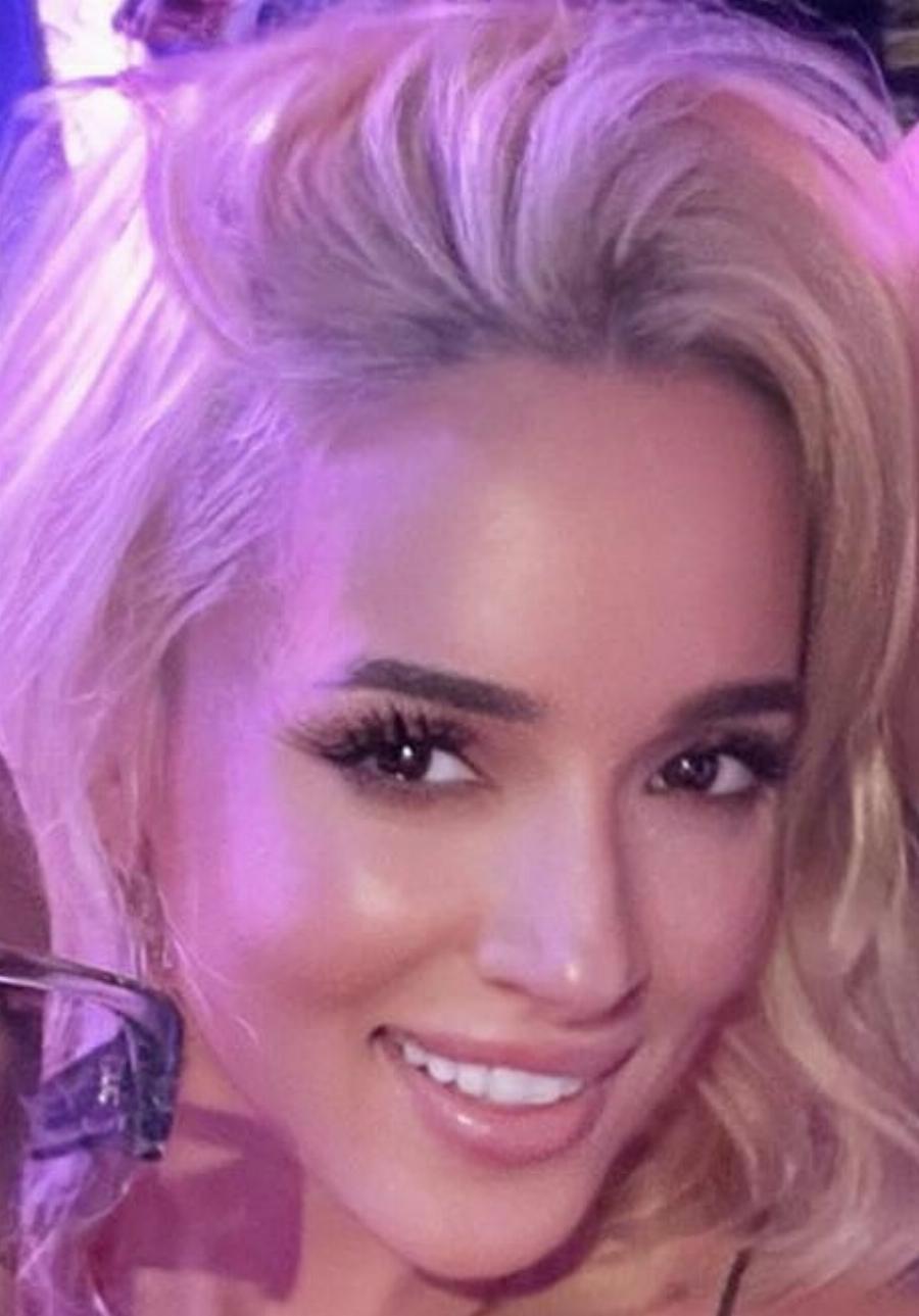 Σχεδόν δεν την αναγνωρίσαμε: Η Καλομοίρα έγινε ξανθιά, έκανε μπότοξ και φούσκωσε τα χείλη της