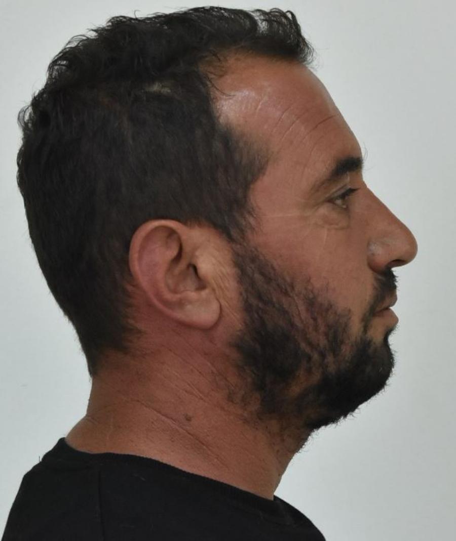 Στη δημοσιότητα το όνομα και οι φωτογραφίες και του δεύτερου συλληφθέντα για τον βιασμό της 12χρονης