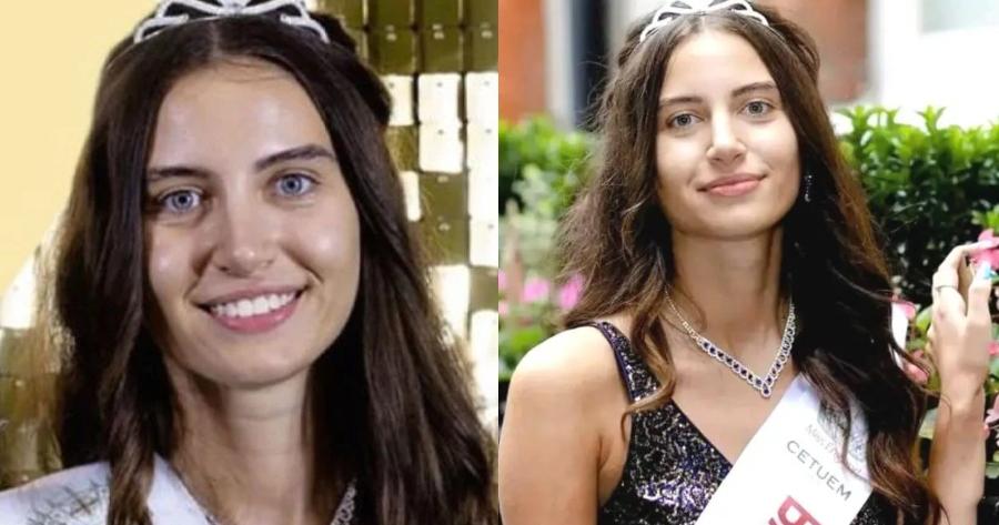 Δεν έχει ξαναγίνει στα 94 χρόνια ιστορίας: Η Μις Αγγλία γίνεται η πρώτη στα καλλιστεία που διαγωνίζεται χωρίς μακιγιάζ