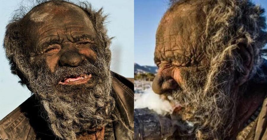 Θλίψη στο Ιράν: Έφυγε από την ζωή ο «πιο βρόμικος άνθρωπος στον κόσμο» – Είχε να πλυθεί 50 χρόνια