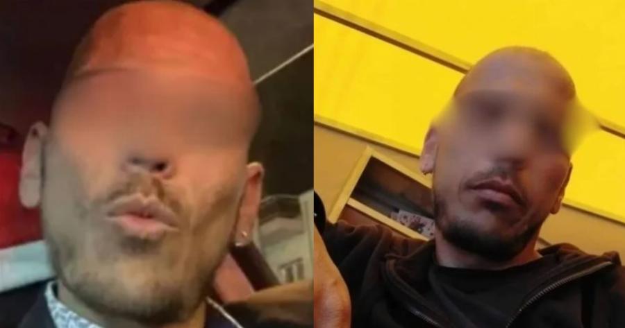 Εξελίξεις στα Σεπόλια: Οδηγείται στη φυλακή και ο 36χρονος εργαζόμενος νοσοκομείου