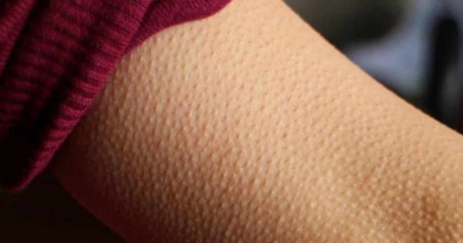 Επιστήμονες: Αν η μουσική σας ανατριχιάζει τότε ο εγκέφαλός σας είναι εξαιρετικός