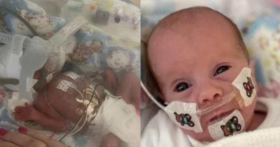 Αληθινή Ιστορία: Πρόωρο μωρό καταδικασμένο να μην ζήσει ούτε ένα λεπτό, γίνεται ενός έτους